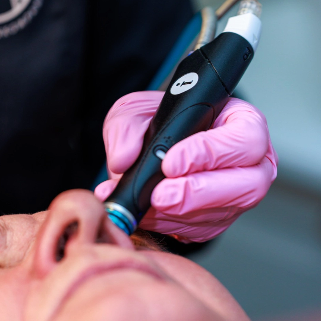 hydrafacial-behandling